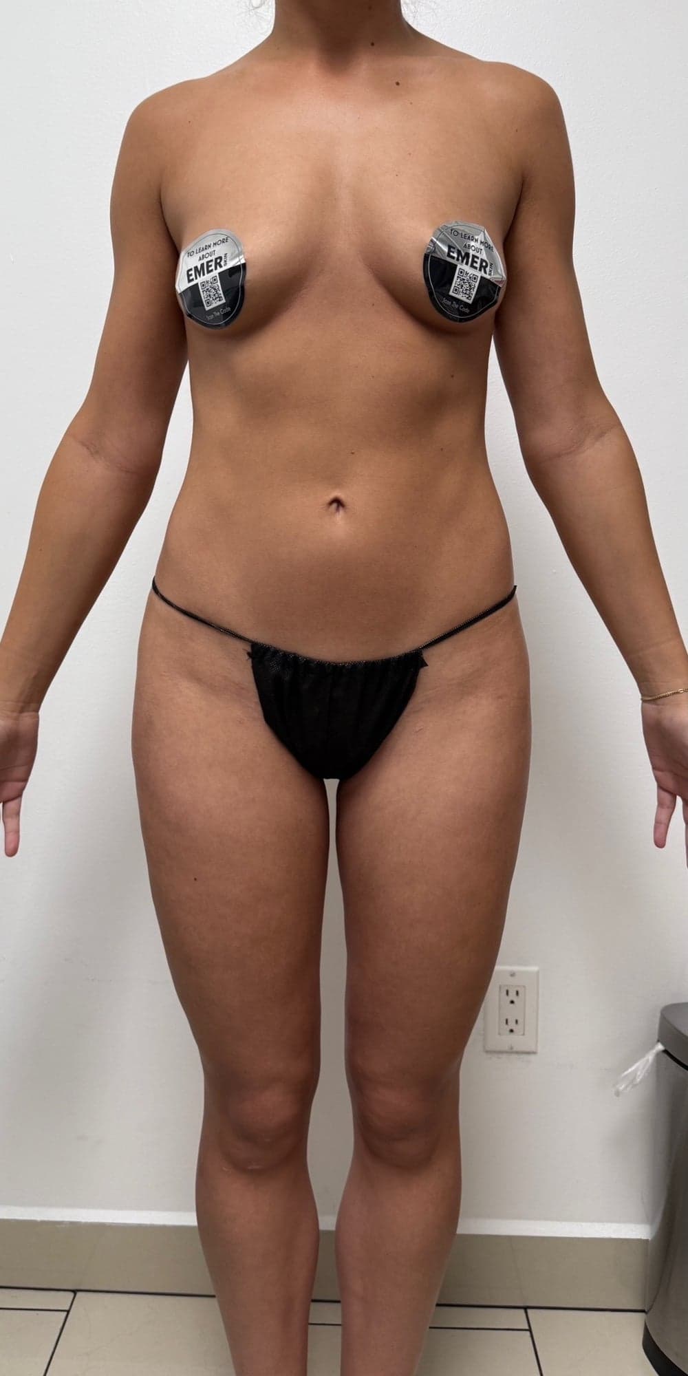 CELESTA 360 HD Lipo — Before